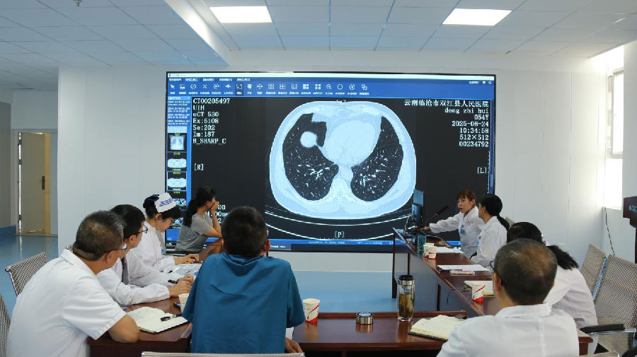 开展MDT讨论（康莎莎 摄）